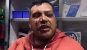 Agreden a periodistas en operativo en la Doctores; SSP de CdMx suspende a mando (Video)