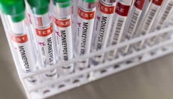 La OMS pide aumentar vigilancia por propagación de la viruela del mono