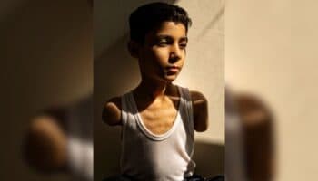 World Press Photo 2025 | Retrato de niño gazatí amputado gana Foto del Año