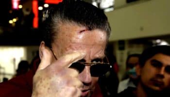 Adame dice que fue atacado por montachoques y muestra la cicatriz de su última pelea