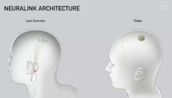 Neuralink consigue aval para realizar ensayo de implante cerebral en humanos con parálisis