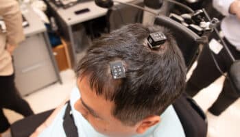 Hombre con parálisis recupera movimientos a través de Inteligencia Artificial