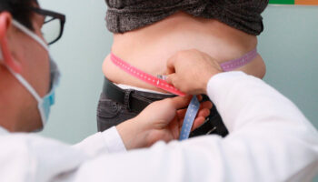 Unicef: Alarmante ola de sobrepeso y obesidad se extiende en niños en AL