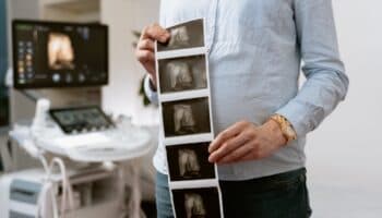 Mujer con dos úteros se embaraza en los dos al mismo tiempo