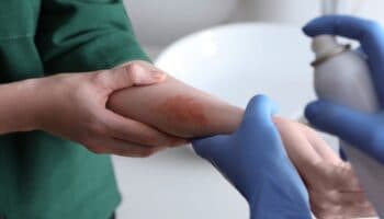 La transición: el reto en salud | Artículo de Roberto Vélez