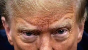 ‘Bala estuvo a 6 milímetros de entrar en su cabeza’: Médico de Trump