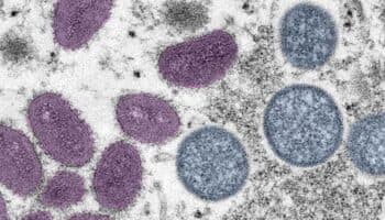 Secretaría de Salud publica aviso epidemiológico por mpox | Documento