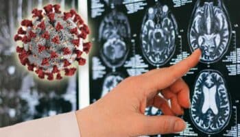 Descubren el mecanismo que utiliza el SARS-CoV-2 para infectar el cerebro