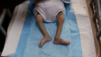 Al menos 57 niños han muerto de hambre en Gaza por bloqueo israelí, estima OMS