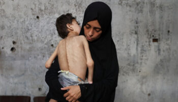 Aumenta desnutrición y mueren más de 18 mil niños en Gaza: UNICEF México