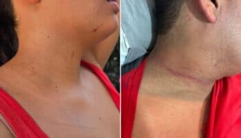 Video | Turistas denuncian agresión policial en Tepoztlán, Morelos