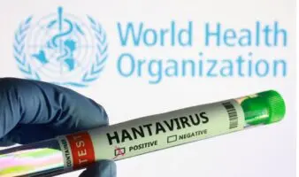 Hantavirus 'no es la Covid': OMS confía que tenga un alcance 'limitado'